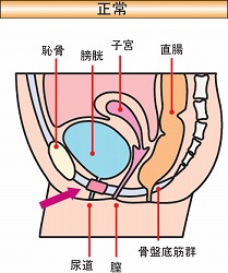 女性泌尿器科外来 - 金沢大学附属病院泌尿器科